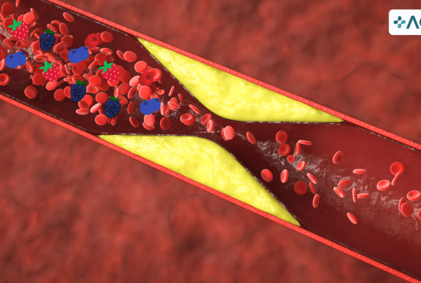 Illustration of an artery with plaque buildup and antioxidants, represented by berries, actively supporting blood flow. The AOX logo in the corner emphasizes the role of antioxidants in managing atherosclerosis naturally.