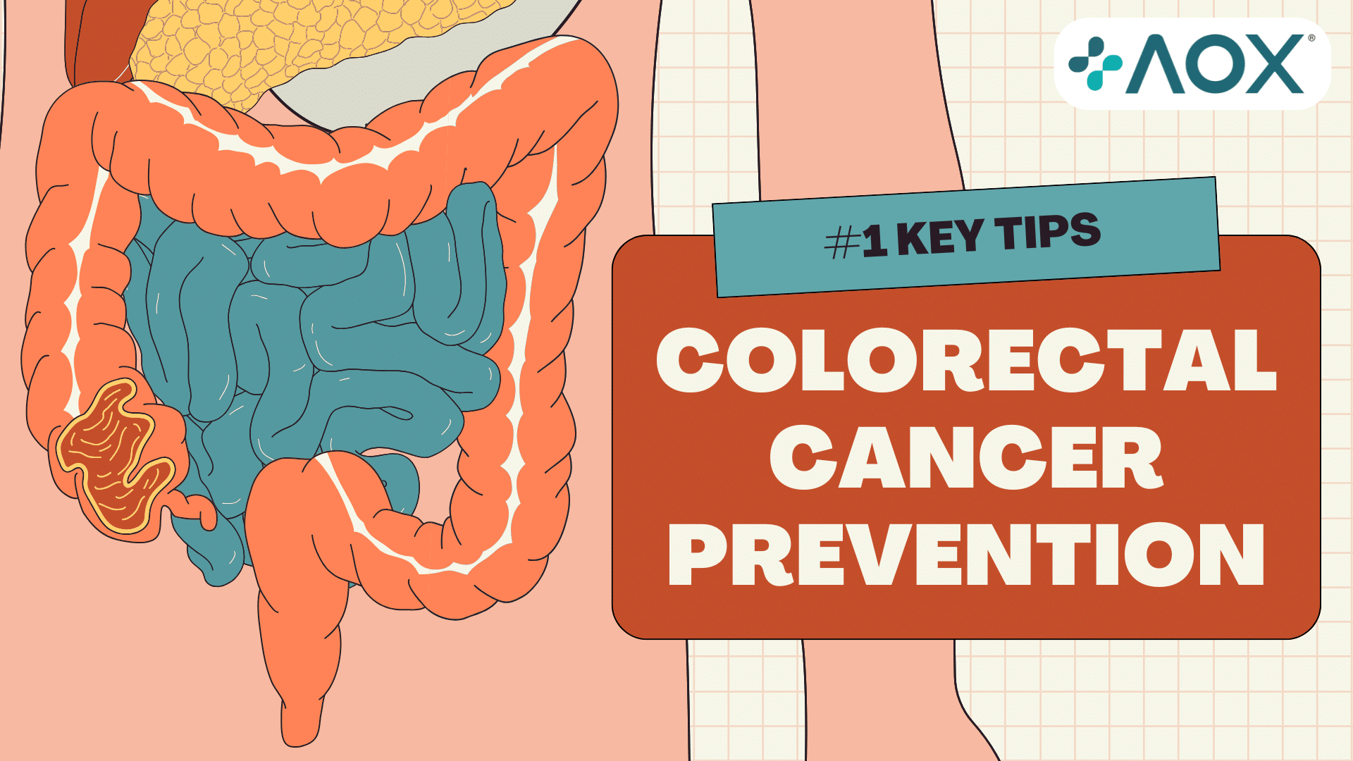 Illustrated infographic of the human digestive system highlighting colorectal cancer prevention with the #1 step: regular screening. Includes AOX branding.